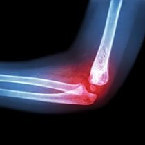 Ortopedi ve Travmatoloji