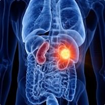 Urology